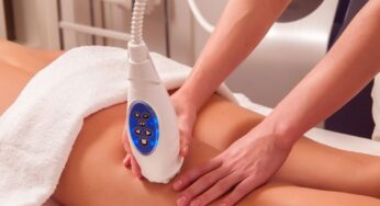 Tratament Vergeturi Laser in Bucuresti