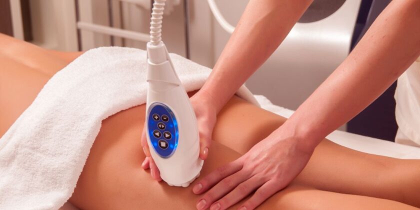 Tratament Vergeturi Laser in Bucuresti