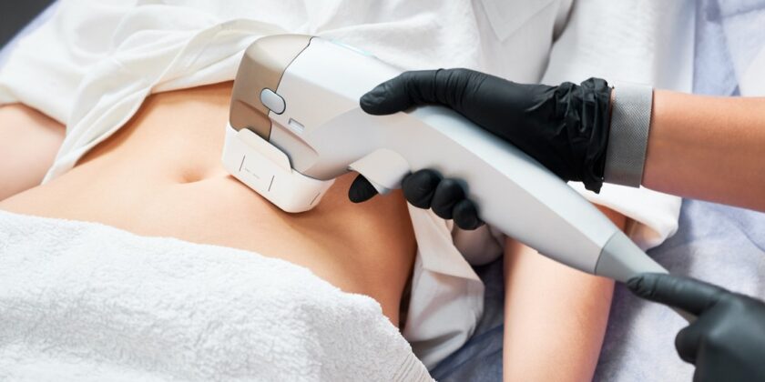 Remodelare corporala abdomen in Bucuresti/Ilfov